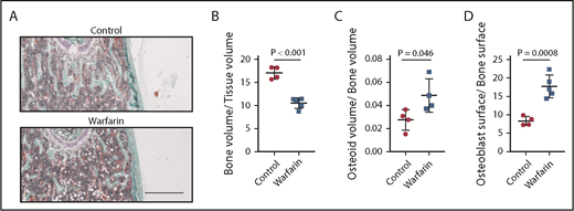 Figure 2. Warfarin impairs the BMM. (A) Trichrome stain of the distal femora of a representative control vs a warfarin-treated mouse. Note the dramatic reduction in cancellous bone (green) in warfarin-treated animals compared with vehicle control. Osteoid is stained in pink above the green cancellous bone. The scale bar depicts 100 μm (n = 5). (B-D) Ratios of bone volume/tissue volume (P < .001; t-test, n = 4-5) (B), osteoid volume/bone volume (P = .046; t-test, n = 4-5) (C), and osteoblast surface/bone surface (P = .0008, t-test, n = 4-5) (D) in control (red circles) vs warfarin-treated (blue squares) mice.