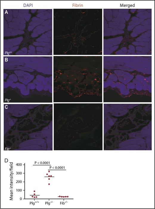 Figure 2. Fibrin(ogen) accumulates in the peritoneal wall of plasminogen-deficient mice after peritoneal thioglycollate injection. Immunofluorescence staining of the peritoneal wall of Plg+/+ mice (A), Plg−/− littermates (B), and Fib−/− mice (C) for fibrin(ogen) 72 hours after peritoneal thioglycollate injection (40×). (D) Mean AI555 intensity representing fibrin accumulation was quantified in 5 fields per mouse. Data are shown as individual values with means indicated. DAPI, 4′,6-diamidino-2-phenylindole.