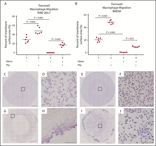 Figure 4. Macrophages require plasminogen to transverse a fibrin matrix in vitro. RAW 264.7 cells (A) and BMDMs (B) were plated into uncoated transwell membranes (1 and 2) or into transwell membranes onto which fibrin had been polymerized (3 and 4) and induced to migrate with C5a in the absence (1 and 3) or presence (2 and 4) of plasminogen. A significant increase in the cellular migration was noted with plasminogen alone (1 vs 2), consistent with previous reports. Cells were essentially unable to migrate in the presence of fibrin without plasminogen (3). However, addition of plasminogen to the cells permitted migration in response to C5a (4). (C-J) Representative images of transwell membranes after overnight incubation with or without fibrin matrix; low power imaging (10×) with higher power magnification (as noted by square outline). Panels D, F, H, and J show the higher power imaging of the transwell membrane. In the absence of fibrin, cells readily migrated without (C-D) or with (E-F) plasminogen. In the presence of fibrin, essentially no cellular migration was noted in the absence of plasminogen (G-H). However, addition of plasminogen restored migration (I-J). Scale bars in panels C, E, G, and I indicate 1 mm. Scale bars in D, F, H, and J indicate 100 µm.