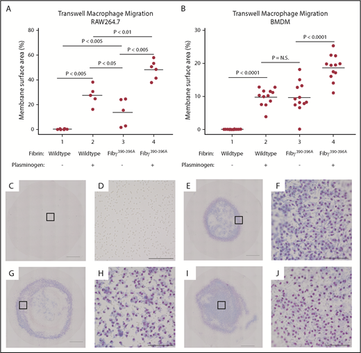 Figure 5. Elimination of the fibrinogen integrin αMβ2-binding motif negates the requirement of plasminogen for macrophage migration through fibrin matrices. Neither RAW 264.7 cells (A) nor BMDMs (B) migrate through wild-type fibrinogen in the absence of plasminogen (Column 1) that is restored in the presence of plasminogen (Column 2). However, neither cell type requires plasminogen to migrate through fibrin matrices if the integrin αMβ2-binding site is abrogated (Column 3). A further increase in migration, even in the absence of the αMβ2-binding motif, is seen with the addition of plasminogen (Column 4). (C-J) Representative transwell membranes from wild-type fibrinogen without (C-D) or with (E-F) plasminogen show migration only in the presence of plasminogen; low power imaging (10×) with higher power magnification (as noted by square outline). Panels D, F, H, and J exhibit higher power imaging of the transwell membrane. Macrophages readily migrated without (G-H) or with (I-J) plasminogen if fibrin was formed from Fibγ390-396A plasma. Scale bars in panels C, E, G, and I indicate 1 mm. Scale bars in panels D, F, H, and J indicate 100 µm. N.S., not significant.