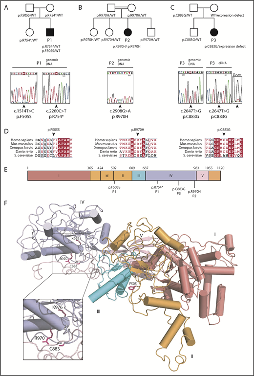 Figure 1. Identification of EFL1 mutations in 3 individuals with SDS. Family pedigrees and direct Sanger sequencing of the EFL1 gene in individuals 1 (P1) (A), 2 (P2) (B), and 3 (P3) (C). Arrows indicate the position of the mutations. (D) Multiple sequence alignment of EFL1 proteins from representative species. Identical amino acids are shown in red with white characters, similar amino acids are in red character, and a blue frame represents similarity across groups. (E) Schematic of the domain architecture of human EFL1 showing the position of disease-associated mutations. Domains I to V are indicated; id, insertion domain (residues 424-502) that distinguishes EFL1 from other translational GTPases. (F) Mapping of SDS-associated mutations onto human EFL1 (Protein Data Bank accession number 5anc4), shown in ribbon representation. Domains are colored deep salmon (I), light orange (id, II), cyan (III), and light blue (IV). Residue K976 corresponds to K983 mutated in the N-ethyl-N-nitrosourea mutant mouse model (see below). WT, wild-type.