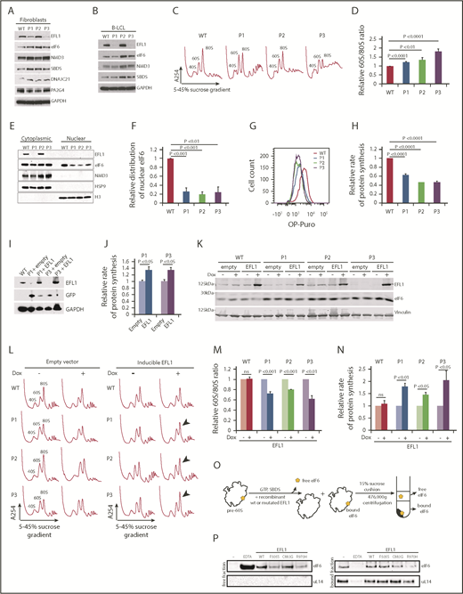 Figure 3. SDS-associated EFL1 mutations impair eIF6 release. (A) Total cell lysates from fibroblasts and (B) B-LCL from wild-type and 3 individuals (P1, P2, and P3) with SDS were immunoblotted to visualize the indicated proteins. (C) Defective ribosome assembly in EFL1 mutant fibroblasts. Polysome profiles from fibroblast extracts from 3 unrelated individuals with SDS compared with wild-type control. Quantification of the 60S:80S ribosomal subunit ratios is indicated as a bar chart (n ≥ 5) (D). EFL1 genotypes are provided in supplemental Table 1. (E) EFL1 is required for eIF6 recycling in human cells. Indicated proteins were visualized by immunoblotting in cytoplasmic or nuclear fractions from wild-type and EFL1 mutant fibroblasts. Histone H3, nuclear marker; HSP9, cytoplasmic marker. (F) Relative amount of eIF6 in the nucleus of EFL1 mutant cells compared with wild-type (n = 5). (G-H) EFL1 deficiency attenuates protein synthesis. OP-Puro incorporation in fibroblast cells lines from individuals P1, P2, and P3 relative to wild-type control cells quantified 1 hour after OP-Puro administration (n = 6). (I) Complementation of EFL1-deficient fibroblasts with wild-type EFL1. Lysates from EFL1 mutant fibroblasts transduced with a vector expressing GFP alone (+empty) or GFP + EFL1 (+EFL1) and from wild-type fibroblasts as a control. The indicated proteins were visualized by immunoblotting. (J) Wild-type EFL1 rescues global translation in patient fibroblast cell lines from P1 and P3 (n = 4). (K) Complementation of EFL1-deficient fibroblasts with inducible vector allows wild-type EFL1 expression after doxycycline (Dox) treatment. Lysates from EFL1 mutant fibroblasts transduced with an empty vector or EFL1-expressing vector with (+) or without (−) doxycycline. Vinculin is used as a loading control. (L) Comparison of polysome profiles from wild-type and EFL1-mutant fibroblasts transduced with empty vector or inducible EFL1-expression vector treated (+) or not (−) with doxycycline. Arrows indicate increased 80S formation in complemented cells from individuals P1, P2, and P3. (M) Quantification of the 60S:80S ribosomal subunit ratios in cells transduced with inducible EFL1-expression vector treated (+) or not (−) with doxycycline (n = 3). (N) Inducible expression of wild-type EFL1 rescues global protein translation rates in EFL1-deficient fibroblast cell lines (n = 6). (O) Schematic of eIF6 release assay. Pre-60S subunits extracted from P3-derived fibroblasts were incubated with the indicated release factors and pelleted through a 15% sucrose cushion. Immunoblotting reveals the eIF6 distribution in the supernatant (“free”) and pellet (“bound”). (P) Release of eIF6 by SDS-associated EFL1 variants. P3-derived pre-60S subunits were incubated with guanosine triphosphate (GTP), SBDS, and the indicated EFL1 variants. EDTA was added as a positive control for eIF6 release. eIF6 and uL14 were visualized by immunoblotting. (−) indicates the negative control lacking EFL1. All data represent mean ± standard error. Statistical significance between samples was assessed by a 2-tailed Student t test. ns, not significant.