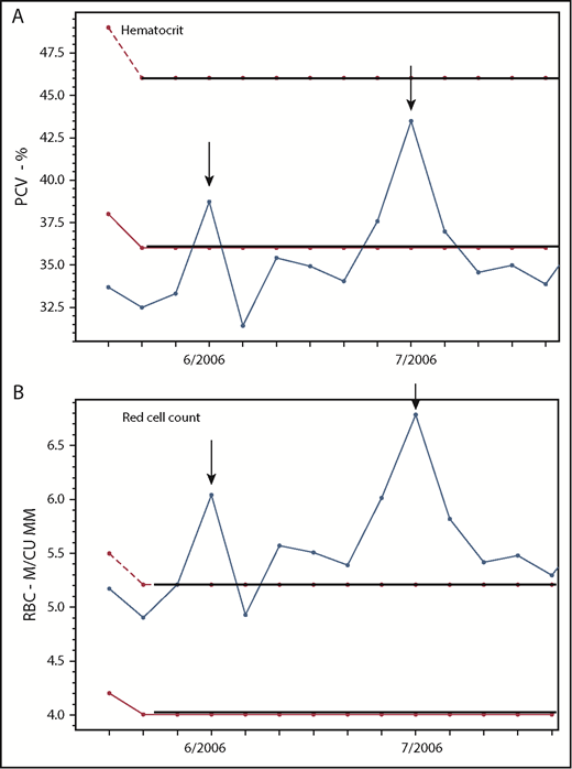 Figure 4. In PV, the red cell count is frequently a better indicator of erythrocytosis than the hematocrit. Changes in the (A) hematocrit and (B) RBC count in a 37-year-old woman with PV-associated HVT treated with phlebotomy, Coumadin, and a transjugular intrahepatic portosystemic shunt (TIPS), demonstrating the correlation of the RBC but not the hematocrit with TIPS thrombosis (arrows) on 2 occasions. M/CU MM, millions per cubic millimeter; PCV, packed cell volume.