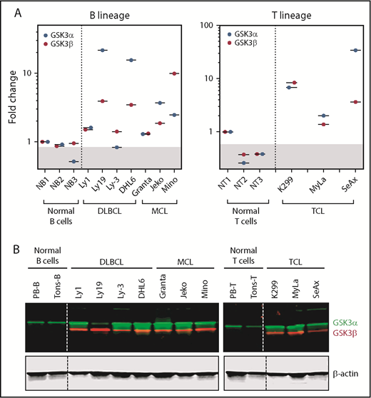 Figure 1. GSK3α and GSK3β mRNA and proteins are overexpressed in lymphomas. (A) Real-time PCR quantitation showing that GSK3α and GSK3β mRNAs are overexpressed in lymphoma lines in comparison with low expression in normal B or T lymphocytes. (B) Western blot images demonstrating that GSK3α and GSK3β proteins are also abundantly expressed in various lymphoma lines in comparison with purified normal B or T lymphocytes.