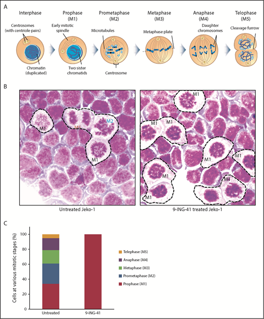 Figure 4. Inhibition of GSK3 by 9-ING-41 leads to mitotic prophase arrest. (A) Cartoon depiction of the sequential steps (M1-M5) during mitosis (purchased from Shutterstock and modified). (B) Representative images of Wright’s stained Jeko cells that were left untreated or treated with 1.0 μM 9-ING-41 for 24 hours. Various mitotic stage cells (M1-M5) are readily identified in untreated cells (left panel), whereas large numbers of only prophase cells (M1) are seen in 9-ING-41–treated cells (right panel); original magnification ×600. (C) Bar chart showing the number of mitotic M1 to M5 cells identified when 100 untreated or 9-ING-41–treated Jeko cells were counted. Similar results (data not shown) were observed in ≥4 lymphoma cell lines.