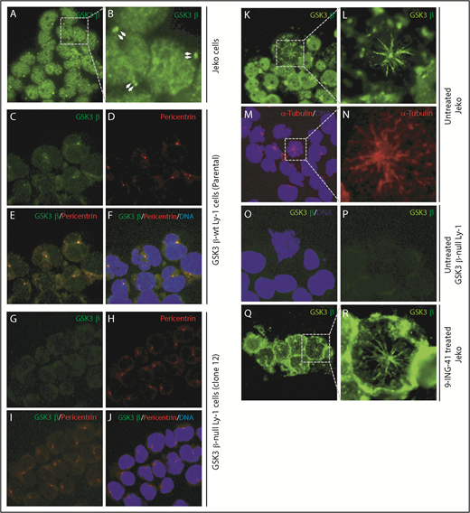 Figure 5. GSK3β localized to centrosomes. (A) Immunofluorescence image showing GSK3β is localized to the nucleus and centrosome pairs in interphase Jeko cells. (B) Enlarged image of the boxed area in panel A. Centrosome pairs are marked by arrows. (C-F) Single- or multichannel images of coimmunostaining of GSK3β and pericentrin in wild-type Ly-1 cells showing their colocalization to the centrosomes. (G-J) Single- or multichannel images of coimmunostaining of GSK3β and pericentrin in GSK3β-null Ly-1 cells showing that staining is specific to GSK3β. (K) Immunofluorescence image showing GSK3β (green) localized to firework-like structures resembling mitotic spindles in mitotic Jeko cells. (L) Enlarged image of the mitotic cell shown in panel K. (M) Overlay image showing the microtubule structure by α-tubulin (red) staining and DNA (blue). (N) Enlarged image of the boxed area in panel M. (O-P) Images showing that spindle structure staining of GSK3β is absent in GSK3β-null Ly-1 cells. (Q) Immunofluorescence image showing GSK3β localized to mitotic spindle structure and polarized centrosomes in 9-ING-41–treated Jeko cells. (R) Enlarged image of the representative mitotic cell shown in panel Q. Original magnification ×600.