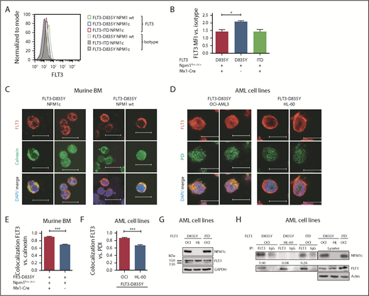 Presence of NPM1c shifts FLT3-D835Y localization to the endoplasmic reticulum. (A) Flow cytometry analysis of FLT3 surface expression reveals reduced FLT3-D835Y expression on the surface in NPM1c+ cells (blue) compared with NPM1 wt cells (green). FLT3-D835Y expression in NPM1c+ cells is comparable to FLT3-ITD surface expression (red). Gray peaks represent isotype controls. (B) Statistical analysis of FLT3-D835Y surface mean fluorescence intensity in NPM1c+ cells compared with NPM1 wt cells (n = 3). (C) Immunofluorescence staining shows colocalization of FLT3-D835Y with the ER marker Calnexin in murine NPM1c+ EGFP+ BM. (D) Immunofluorescence staining shows colocalization of FLT3-D835Y with the ER marker PDI in a NPM1c+ AML cell line (OCI-AML3), but not in NPM1 wt expressing HL-60 cells. (E) Mander’s coefficient analysis for colocalization of FLT3 with Calnexin in murine FLT3-D835Y+ NPM1c+ BM cells (n = 9 images with 49 cells) and in FLT3-D835Y+ NPM1 wt BM cells (n = 6 images with 189 cells). (F) Mander’s coefficient analysis for colocalization of FLT3-D835Y with PDI in OCI-AML3 (n = 6 images with 169 cells) and HL-60 cells (n = 4 images with 57 cells). (G) Immunoblot analysis of AML cell line lysates reveals expression of underglycosylated ER-localized 130-kDa form of FLT3-D835Y and FLT3-ITD in OCI-AML3, but not in HL-60, cells. (H) Co-immunoprecipitation of FLT3 shows interaction with NPM1c in OCI-AML3 FLT3-D835Y cells, low interaction in OCI-AML3 FLT3-ITD and no interaction in HL-60 FLT3-D835Y (negative control) cells. (I) Intracellular flow cytometric analysis of pSTAT5 in c-kit+ BM blasts from representative patients with AML reveals a significantly increased STAT5 activation in FLT3-TKD/NPM1c cells compared with FLT3-TKD/NPM1 wt cells (FLT3-TKD/NPM1c: n = 4 patients; FLT3-TKD/NPM1 wt: n = 4 patients). (J) Representative immunohistochemical staining of pSTAT5 in BM from patients with AML with cooccurred FLT3-TKD and NPM1c mutations shows increased positivity for pSTAT5 (red color) compared with samples from patients harboring FLT3-TKD together with NPM1 wt. (K) Flow cytometric analysis of BM cells from patients with AML reveals significantly decreased FLT3-TKD surface levels in NPM1c+ compared with NPM1 wt patient cells (FLT3-TKD/NPM1c: n = 5 patients; FLT3-TKD/NPM1 wt: n = 6 patients). *P < .05 and ***P < .001, by unpaired, 2-tailed Student t test (panels B, E, F, I and K).