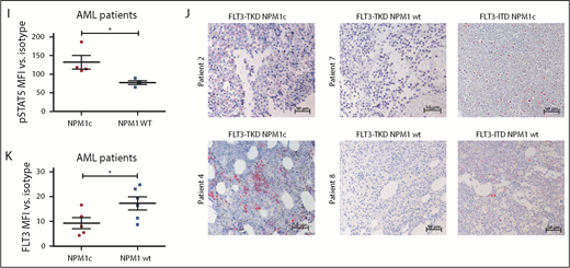 Presence of NPM1c shifts FLT3-D835Y localization to the endoplasmic reticulum. (A) Flow cytometry analysis of FLT3 surface expression reveals reduced FLT3-D835Y expression on the surface in NPM1c+ cells (blue) compared with NPM1 wt cells (green). FLT3-D835Y expression in NPM1c+ cells is comparable to FLT3-ITD surface expression (red). Gray peaks represent isotype controls. (B) Statistical analysis of FLT3-D835Y surface mean fluorescence intensity in NPM1c+ cells compared with NPM1 wt cells (n = 3). (C) Immunofluorescence staining shows colocalization of FLT3-D835Y with the ER marker Calnexin in murine NPM1c+ EGFP+ BM. (D) Immunofluorescence staining shows colocalization of FLT3-D835Y with the ER marker PDI in a NPM1c+ AML cell line (OCI-AML3), but not in NPM1 wt expressing HL-60 cells. (E) Mander’s coefficient analysis for colocalization of FLT3 with Calnexin in murine FLT3-D835Y+ NPM1c+ BM cells (n = 9 images with 49 cells) and in FLT3-D835Y+ NPM1 wt BM cells (n = 6 images with 189 cells). (F) Mander’s coefficient analysis for colocalization of FLT3-D835Y with PDI in OCI-AML3 (n = 6 images with 169 cells) and HL-60 cells (n = 4 images with 57 cells). (G) Immunoblot analysis of AML cell line lysates reveals expression of underglycosylated ER-localized 130-kDa form of FLT3-D835Y and FLT3-ITD in OCI-AML3, but not in HL-60, cells. (H) Co-immunoprecipitation of FLT3 shows interaction with NPM1c in OCI-AML3 FLT3-D835Y cells, low interaction in OCI-AML3 FLT3-ITD and no interaction in HL-60 FLT3-D835Y (negative control) cells. (I) Intracellular flow cytometric analysis of pSTAT5 in c-kit+ BM blasts from representative patients with AML reveals a significantly increased STAT5 activation in FLT3-TKD/NPM1c cells compared with FLT3-TKD/NPM1 wt cells (FLT3-TKD/NPM1c: n = 4 patients; FLT3-TKD/NPM1 wt: n = 4 patients). (J) Representative immunohistochemical staining of pSTAT5 in BM from patients with AML with cooccurred FLT3-TKD and NPM1c mutations shows increased positivity for pSTAT5 (red color) compared with samples from patients harboring FLT3-TKD together with NPM1 wt. (K) Flow cytometric analysis of BM cells from patients with AML reveals significantly decreased FLT3-TKD surface levels in NPM1c+ compared with NPM1 wt patient cells (FLT3-TKD/NPM1c: n = 5 patients; FLT3-TKD/NPM1 wt: n = 6 patients). *P < .05 and ***P < .001, by unpaired, 2-tailed Student t test (panels B, E, F, I and K).