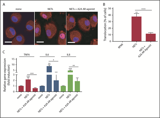 Figure 6. An A2AAR agonist decreases NF-κB nuclear translocation and NET-induced proinflammatory cytokine production in macrophages. Control macrophages were incubated with NETs in the presence or absence of A2AAR agonist. (A) Translocation of NF-κB (in red) was impaired in cells treated A2AAR agonist. Nuclei were stained in blue. Scale bar, 10 µm. (B) Translocation of NF-κB was quantified and graphed as a percentage of total cells. (C) Gene expression analysis shows A2AAR agonist significantly decreased NET-induced proinflammatory cytokine in macrophages. *P < .05, **P < .01, ***P < .001, ****P < .0001, Mann-Whitney U test. Results are the means ± SEM of n = 4-5.