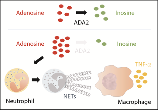 Deficiency of ADA2 triggers NET formation, which activates macrophages to produced TNF-α.