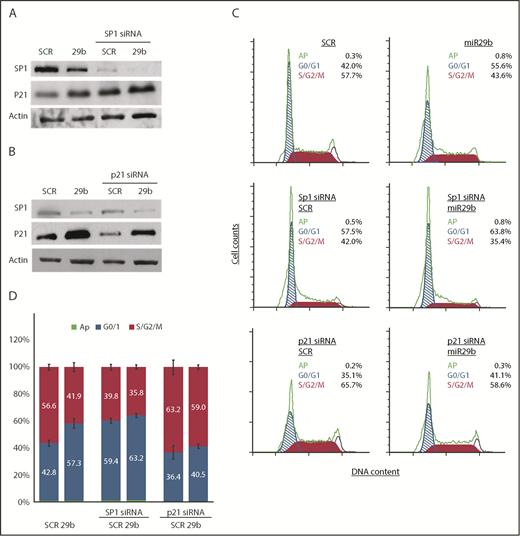 Figure 6. miR-29b suppressed leukemic cell proliferation in SP1/p21–dependent manner. (A) 2A2-miR-29b-ILP (29b) downregulated SP1 and increased p21 expression in the human OSU-CLL cell line (lanes 1 and 2). The siRNA-mediated knockdown of SP1 resulted in increased p21 expression (lanes 3 and 4). (B) Transfection of p21-directed siRNA decreased control (SCR) as well as 2A2-miR29b-ILP (29b) induced p21 protein. (C-D) Accumulation of cells in G0/G1 with concomitant decrease in S/G2/M by miR-29b that is reversed upon SP1 and p21 knockdown in OSU-CLL cells. Panel C shows results from a representative experiment. Panel D presents compiled data from 4 independent experiments.