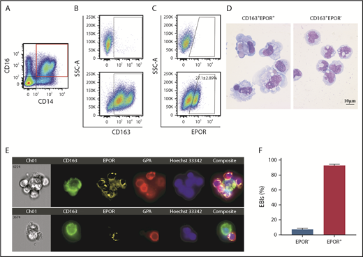 Figure 6. Expression of EPOR in human FL EBI macrophages. (A) Representative plot of CD14 vs CD16 in human FL CD45+ cells. (B) Representative plot of CD163 vs SSC-A of the CD14+CD16+ cells. Top, FMO; bottom: CD163 expression. (C) Representative plot of EPOR vs SSC-A of CD163+ cells. Upper panel: FMO; lower panel: EPOR expression; (D) Representative cytospin images of sorted human FL CD163+EPOR+ macrophages and CD163+EPOR− macrophages. N = 5. (E) Top: a representative EBI structure showing CD163+EPOR+ was surrounded by multiple GPA+ erythroid cells; bottom: a representative image showing the CD163+EPOR− macrophage was surrounded by 1 erythroid cell. (F) Quantitative analyses of human FL EBIs. Quantitative analyses of EBIs were performed using 200 EBIs from 2 independent experiments. FMO, fluorescence minus one.