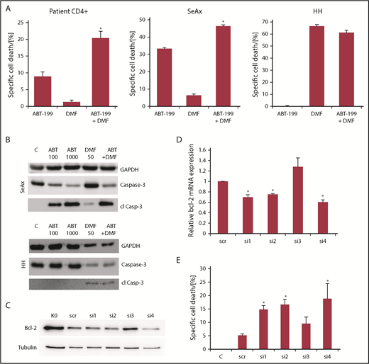 Figure 2. Bcl-2 inhibitors and DMF synergistically induce cell death in primary patient CTCL cells and CTCL cell lines. (A) Specific cell death in primary CD4+ cells isolated from 5 patients with Sézary syndrome (left), SeAx (middle) or HH cells (right) (n = 4 for HH and SeAx) upon treatment with 100 nM ABT-199, 30 µM DMF or the combination of both drugs. *P < .05 from ABT-199 monotreatment. (B) Western blot analysis of caspase 3 cleavage in SeAx and HH cells (as indicated) after treatment with 100 or 1000 nM ABT-199, 50 µM DMF or the combination of 1000 nM ABT-199 and 50µM DMF, as indicated. (C) Representative western blot analysis of SeAx Bcl-2 expression following AMAXA transfection with different siRNAs against bcl-2 after 24 hours. (D) Quantification of signal intensities from western blots for Bcl-2 in SeAx cells following AMAXA transfection with different siRNAs against Bcl-2 after 24 hours (n = 4). *P < .05 from scrambled siRNA control. (E) Specific cell death in SeAx cells transfected with different siRNAs against bcl-2 for 24 hours and treated with 30 µM DMF for another 24 hours (n = 4). *P < .05 from scrambled siRNA control.