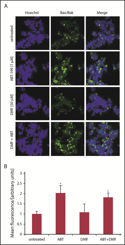 Figure 3. Bcl-2 inhibition induces Bax/Bak oligomerization in CTCL cell lines depending on their Bcl-2 activity. (A) Complex formation of Bax and Bak was determined by PLA in SeAx cells either treated with ABT-199, DMF or the combination of both drugs, as indicated. Vehicle treated cells served as control. Bax/Bak association is depicted by green fluorescence; blue fluorescence indicates nuclear staining with Hoechst dye; shown are representative immunofluorescence analyses from z-stacks. Original magnification ×400. (B) Quantification of mean fluorescence intensities of PLA signals (n = 4). *P < .05 from untreated control.