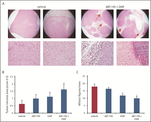 Figure 5. Combined Bcl-2 and NF-κB inhibition HE-morphologically blocks proliferation and induces cell death specifically within CTCL tumors in vivo. SeAx xenograft tumors growing intradermally in NSG mice that were treated as described under Figure 4 were used (A) Representative H&E-stained specimens of primary SeAx tumors from the vehicle control and the combination group (upper panels 20x, lower panels 200x). Red arrows mark necrotic areas. (B) Semiquantitative score of necrotic areas in the primary SeAx xenograft tumors (0% to 25% tumor area covered by necrosis = 0; 25% to 50% tumor area covered by necrosis = 1; 50% to 75% tumor area covered by necrosis = 2; 75% to 100% tumor area covered by necrosis = 3). (C) Quantification of the mitosis count per view under 200x magnification in the 4 treatment groups.