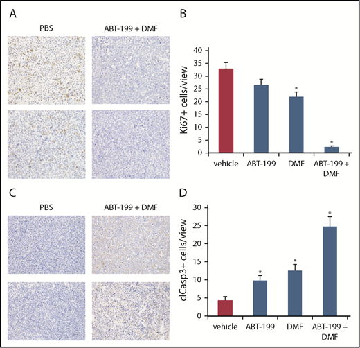 Figure 6. Combined Bcl-2 and NF-κB inhibition blocks proliferation and induces apoptosis specifically within CTCL tumors in vivo in immunohistochemistry. (A) Representative specimens of primary SeAx tumors from the vehicle control and the combination group. Immunohistochemical detection of cellular positivity for the proliferation marker Ki-67 (×400). (B) Quantification of the Ki-67+ cell count per view under ×400 magnification in the 4 treatment groups. (C) Representative specimens of primary SeAx tumors from the vehicle control and the combination group. Immunohistochemical detection of cellular positivity for cleaved caspase-3 as a readout for apoptotic activity (×400). (D) Quantification of the cleaved caspase-3-positive cell count per view under ×400 magnification in the 4 treatment groups.