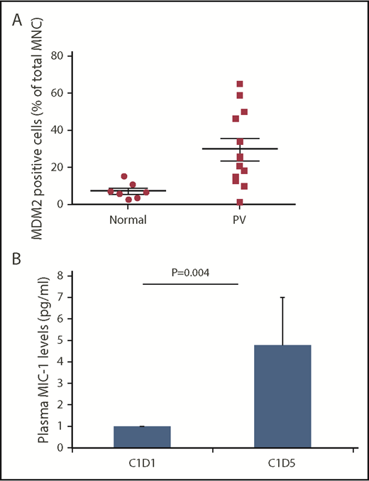Figure 2. Baseline MDM2 and day-5 plasma MIC-1 levels. (A) Baseline MDM2 levels were higher in patients with PV/ET compared with normal controls. The pretreatment MNC median MDM2 level was approximately fourfold higher in the PV/ET patients enrolled on the study compared with normal controls. (B) Plasma MIC-1 levels are increased on day 5 of idasanutlin therapy. p53 pathway activation is reflected by a 4.8-fold increase from baseline of MIC-1 protein levels by day 5 (P = .004).