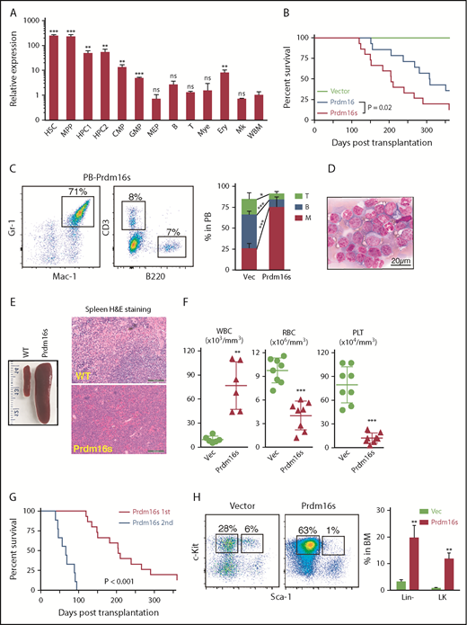 Figure 1. Prdm16s expression in HSPCs causes AML. (A) Relative expression levels of Prdm16 in murine hematopoietic cells compared with whole bone marrow (WBM) cells (n = 3). (B) Survival of mice after transplanting LSK cells transduced with empty vector (vec; n = 10), Prdm16 (n = 14), or Prdm16s (n = 15). (C) Flow cytometric analysis revealed increased myeloid cells (Mac-1/Gr-1+) in the peripheral blood (PB) of recipients transplanted with Prdm16s-transduced LSK cells compared with vector-transduced LSK cells (n = 10). (D-E) Representative images of Wright-Giemsa–stained PB cells (D) and spleens from wild-type (WT) mice and mice transplanted with Prdm16s-transduced LSK cells (E). (F) Increased white blood cells (WBCs; n = 6), decreased red blood cells (RBCs; n = 8), and platelets (PLTs; n = 8) in recipient mice of Prdm16s-transduced cells. (G) Secondary recipients (n = 10) of Prdm16s-transduced cells developed AML with a shorter latency than the primary recipient mice (n = 15). (H) Increased lineage− and lineage−Sca-1−c-kit+ (LK) myeloid progenitor cells in the bone marrow (BM) of recipients transplanted with Prdm16s-transduced cells (n = 5). Flow cytometric plots are gated on lineage− cells. All data represent mean ± standard deviation. *P < .05, **P < .01, ***P < .001 by Student t test, except for comparison of survival curves, in which significance was assessed by log-rank test. B, B cell; CMP, common myeloid progenitor; Ery, erythrocyte; H&E, hematoxylin and eosin; HPC, hematopoietic progenitor cell; Mk, megakaryocyte; Mye, myeloid cell; ns, not significant; T, T cell.