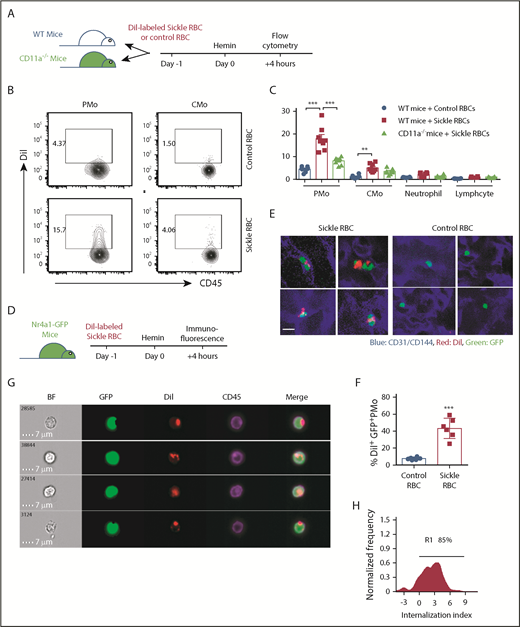 Figure 3. PMos uptake sickle RBCs in vivo. (A) Schematic representation of experimental design. WT mice or CD11a−/− mice were transfused with DiI-labeled RBCs from sickle Townes or control HbAA mice. At 20 hours after transfusion, mice were injected IV with freshly prepared hemin and analyzed 4 hours later. (B) Representative dot plots comparing DiI+ PMos (CD45+CD11b+Ly-6G-CD115+Ly-6C−) and CMo (CD45+CD11b+Ly-6G-CD115+Ly-6C+) from WT mice. For the gating strategy used, see supplemental Figure 4B. (C) Frequencies of DiI+ circulating leukocyte subsets in WT mice (n = 8) and CD11a−/− mice (n = 8). (D) Schematic representation of experimental design; Nr4a1-GFP mice received treatment as shown in panel A and were analyzed with immunofluorescence following perfusion with PBS to wash out nonattached circulating blood cells. (E) Representative immunofluorescence images showing the uptake of DiI+ RBCs by GFP+ PMos on the endothelial surface of liver and lung in mice that received DiI-labeled sickle RBCs or control RBCs. CD31/CD144 (endothelial markers, blue), DiI (RBC in red), and GFP (PMo, green). Scale bar, 5 µm. (F) The frequencies of GFP+ PMos with uptake of DiI+ RBC (DiI+ GFP+ PMos) in mice as shown in panel E. (G) Representative IFC images acquired and gated on DiI+ PMos from hemin-treated Nr4a1-GFP reporter mice. Left to right: single-channel BF, GFP (representing PMos in green), DiI (representing sickle RBC material in red), CD45 (representing surface PMos in purple), and merged images showing DiI+ materials within GFP+CD45+ PMos. (H) Histogram depicting degree of DiI+ material internalized within GFP+ PMos with internalization score (<0 represents DiI+ material attached to the surface of PMo; >0 represents DiI+ material internalized by PMos). Percentage of cells with an internalization score >0 is indicated. Data represent mean ± SEM; means were compared using a 2-tailed Student t test. **P < .01; ***P < .001.
