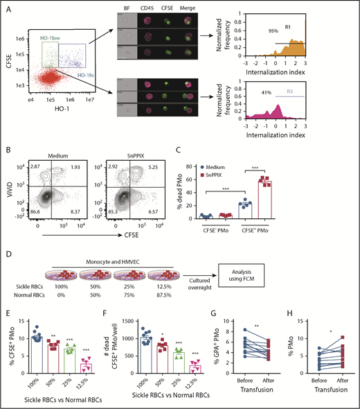 Figure 4. Survival of PMos in SCD. (A) Representative IFC dot plot showing HD PMos gated on CFSE+ HO-1hi and CFSE+ HO-1low subpopulation in cocultures of monocyte/HMVEC/sickle RBCs. CFSE+HO-1hi PMos and CFSE+ HO-1low PMos were further analyzed and shown by representative IFC images and internalization index depicted by histograms. Left to right: single-channel BF, CD45 (representing PMo in purple), CFSE (representing RBC material), and merged images showing the position of CFSE+ materials with CD45+ cells. The internalization score was defined as in Figure 1D. (B) Representative dot plots comparing the frequencies of dead cells (ViViD+ cells) in PMos cultured with CFSE-labeled sickle RBCs and HMVECs in the presence of the HO-1 activity blocker SnPPIX or control (culture media). (C) The frequencies of dead PMos in HD PMo subpopulations of CFSE+ PMos (ie, RBC phagocytosed PMos) and CFSE− PMos (ie, no RBC uptake) are shown as in panel B (n = 5). (D) Schematic representation of experimental design. CFSE-labeled RBCs were mixed with HD RBCs to mimic transfusion in patients with SCD and then cultured with HD monocytes and HMVECs. The uptake of CFSE+ RBCs by PMos was analyzed by FCM. Frequencies of CFSE+ PMos from HD (n = 5-10; E) and absolute number of dead CFSE+ PMos (n = 5-10; F) in the coculture as defined in panel D. (G) Frequencies of GPA+ circulating PMos (G) and percentage of PMos within total monocytes in patients with SCD (n = 12; H) before or after transfusion. Data represent mean ± SEM; means were compared using a 2-tailed Student t test. *P < .05; **P < .01; ***P < .001.