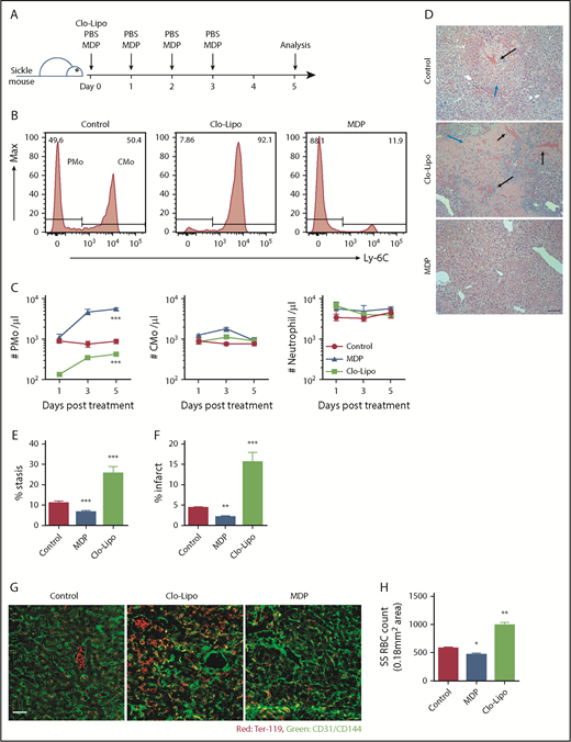 Figure 5. Detection of vaso-occlusion in Townes sickle mice following manipulation of PMo numbers. (A) Experimental design for manipulation of PMo numbers in Townes sickle mice with Clo-Lipo and MDP. Sickle mice (8-12 weeks) were injected IV with MDP daily from day 0 to day 3 or with Clo-Lipo at day 0 or with PBS daily from day 0 to day 3. Mice were sacrificed at day 5 for histological analysis. (B) Representative histograms showing the frequencies of PMos (CD45+CD11b+Ly-6G−CD115+Ly-6C−) and CMos (CD45+CD11b+Ly-6G−CD115+Ly-6C+) in 3 groups of sickle mice as defined in panel A. (C) The absolute number of circulating PMos, CMos, and neutrophils in 3 groups of mice (n = 6-7) as defined in panel A. (D) Representative H&E-stained liver sections in 3 groups of mice (scale bar, 200 µm). Black arrows indicate RBC stasis within blood vessels. Blue arrows indicate infarct. (E) Frequencies of blocked blood vessels (stasis) in total blood vessels in liver sections in 3 groups of mice (n = 6 in each group). (F) Frequencies of area of necrosis (infarct) in liver sections in 3 groups of mice (n = 6 in each group). (G) Representative immunofluorescence staining of liver sections from 3 groups of mice showing CD31/CD144 (endothelial markers, green) and Ter-119 (RBC marker, red). Scale bar, 50 µm. (H) Enumeration of Ter-119+ RBCs per image (0.18 mm2 area) in liver sections in 3 groups of mice (n = 6-7 in each group) as quantified using ImageJ software. Data represent mean ± SEM. Means in panel C were compared using 2-way ANOVA, and means in panel F were compared using a 2-tailed Student t test. *P < .05; **P < .01; ***P < .001.