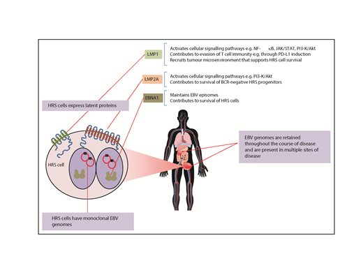 Figure 2. Molecular evidence of a pathogenic role for EBV in cHL.