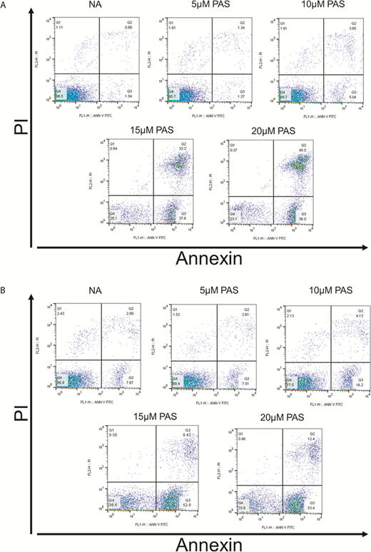 Figure 2. Annexin V/PI analysis of CLL cells treated with PAS. Cells from patient AS31 with functional p53 (A) or patient AS32 with more than 97% p53 deletion (B) were treated with 0, 5, 10, 15, and 20 μM PAS for 24 hours. Apoptosis was quantified by annexin V/PI FACScan analysis. Values in each quadrant represent the percentage of gated cells in each quarter.
