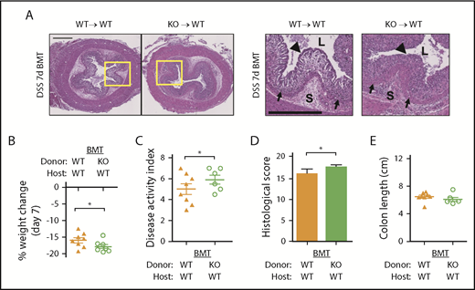 Figure 3. Loss of HYAL2 in hematopoietic cells exacerbates DSS-induced colitis. Bone marrow transplant (BMT) chimeras were generated by using WT (HYAL2+/+) and KO (HYAL2−/−) mice as host and BM donor, respectively. (A) Cross-sections of distal colon collected from mice after 7 days of 2.5% DSS. Hematoxylin-eosin staining reveals the cellular and structural changes in the intestine, including inflammatory leukocyte infiltration. Boxed regions are enlarged in adjacent panels. Scale bars indicate 500 μm. L denotes the intestinal lumen, triangles indicate the epithelial layer, S denotes the submucosa, and arrows indicate the muscularis mucosae. (B) Body weight was measured on day 7 and compared with starting weight. (C) Mice were scored for outward signs of disease, including weight loss, hunched posture, ruffled fur, bloody stools, and rectal prolapse. (D) Distal colon sections from mice after 7 days of DSS were scored for pathologic changes, including erosion of the epithelial layer, leukocyte infiltration, submucosal swelling, muscularis mucosae hyperplasia, and increased vascularization. (E) Colons from mice euthanized after 7 days of DSS were measured for distance (centimeters) from the distal end of the cecum to the rectum. Symbols indicate genotypes and treatment: (▲) WT mice receiving WT BM, n = 8; and (○) WT mice receiving HYAL2 KO BM, n = 7. Data are reported as mean ± SEM. *P < .05.