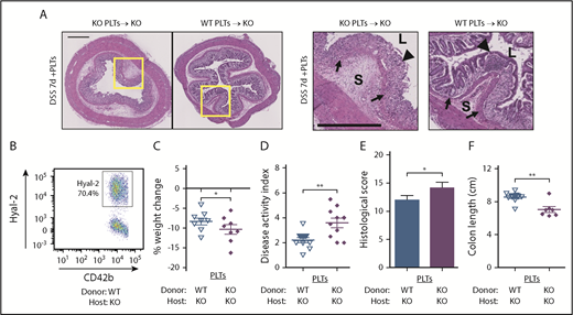 Figure 4. Platelet HYAL2 mediates susceptibility to colitis. Mice received adoptive transfer of 8 × 108 WT or KO platelets as indicated at the onset of DSS treatment. (A) Cross-sections of distal colon collected from mice after 7 days of 2.5% DSS. Hematoxylin-eosin staining reveals the cellular and structural changes in the intestine, including inflammatory leukocyte infiltration. Boxed regions are enlarged in adjacent panels. Scale bars indicate 500 μm. L denotes the intestinal lumen, triangles indicate the epithelial layer, S denotes the submucosa, and arrows indicate the muscularis mucosae. (B) The percentage of platelets expressing HYAL2 in KO mice receiving WT platelets assessed by using flow cytometry. (C) Body weight was measured on day 7 and compared with starting weight. (D) Mice were scored for outward signs of disease, including weight loss, hunched posture, ruffled fur, bloody stools, and rectal prolapse. (E) Distal colon sections from mice after 7 days of DSS were scored for pathologic changes, including erosion of the epithelial layer, leukocyte infiltration, submucosal swelling, muscularis mucosae hyperplasia, and increased vascularization. (F) Colons from mice euthanized after 7 days of DSS were measured for distance (centimeters) from the distal end of the cecum to the rectum. Symbols indicate genotypes and treatment: (∇) KO mice transfused with WT platelets, n = 8; and (♦) KO mice transfused with KO platelets, n = 8. Data are reported as mean ± SEM. *P < .05; **P < .01.