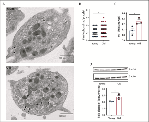 Figure 3. Platelets from old mice exhibit significantly higher mitochondrial mass. (A-B) Quantification of platelet mitochondrial mass by TEM, flow cytometry (C), and by (D) immunoblotting of the mitochondrial protein Tom20 (n = 3-6 mice per group; mean plus or minus SEM). MFI, mean fluorescence intensity.