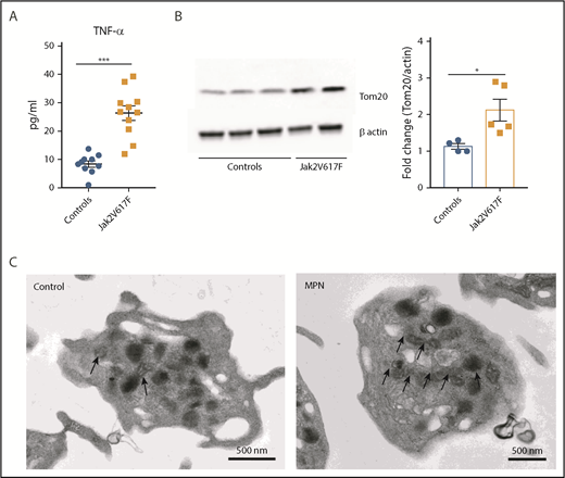 Figure 6. Jak2 V617F+ MPN is associated with increased circulating levels of TNF-α and higher platelet mitochondrial mass. (A) Plasma TNF-⍺ levels of healthy controls and Jak2 V617F+ MPN patients. (B) Representative immunoblot (left) and biochemical quantification (right) of the mitochondrial protein Tom20 between healthy controls and Jak2 V617F+ MPN patients. (C) Representative TEM images of platelets from healthy controls and Jak2 V617F+ MPN patients with black arrows depicting the significantly higher mitochondrial content in platelets from Jak2 V617F+ MPN patients (n = 4-12; mean plus or minus SEM). *P < .05; **P < .01; and ***P < .001. Student t test and Mann-Whitney test.