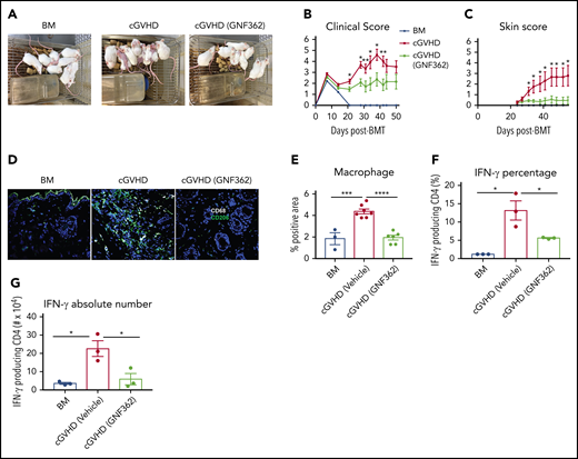 GNF362 treatment reversed skin disease in mice with cGVHD and scleroderma. Lethally irradiated BALB/c mice underwent B10.D2 BM transplantation, only or with purified B10.D2 T cells (CD4+ T cells, CD8+ T cells: 1.8 × 106 and 0.9 × 106, respectively). GNF362 treatment was started at day 21. (A) Photographs of mice in the BM only, vehicle-treated, and GNF362-treated cGVHD groups. (B) Clinical manifestations of cGVHD were assessed by scoring weight loss, activity, posture, and fur condition. Healthy mice receive a score of 0. (C) Skin scores were assessed by measuring the area of skin with fur loss or sclerodermatous lesion. Intact skin was given a score of 0 (n = 12 per group). (D) Macrophage CD68, and M2 macrophage CD206 fluorophores were used to stain skin of transplanted mice. Confocal images were acquired on an Olympus FluoView500 Confocal Laser Scanning Microscope at original magnification ×200. (E) Quantification of macrophages (CD68+CD206+) by Fiji software. (F-G) Lymph nodes were harvested and pooled (3 mice lymph nodes for each data point) on posttransplant day 55. Single suspension of lymphocytes from lymph nodes was stimulated in vitro. CD4+ IFN-γ production was evaluated by flow cytometry (n = 3 data points/group). Results shown are representative of 2 independent experiments with similar results. *P < .05, **P < .01, ***P < .001, and ****P < .0001.