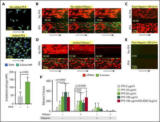 Effect of PF4 on endothelial cells and microbial entrapment by NETs in vitro. Channels lined with TNF-α–stimulated HUVECs were infused with isolated human neutrophils treated with LPS (100 ng/mL) to induce NETosis with and without hPF4 (25 µg/mL). (A) Channels were incubated with the neutrophils for 16 hours, after which the number of residual adherent endothelial cells was counted using ImageJ. (Top) Representative images of remaining attached endothelial cells channels per condition. Size bar and arrows indicate direction of flow. Bottom: mean of endothelial cell counts in 3 ×10 high-powered fields per condition ± 1 SD. Statistical analysis was performed using a Mann-Whitney U test. n = 6 channels per arm. (B) Left shows representative images of NET-lined channels infused with fluorescently labeled S aureus with observed bacterial capture. Size bar and arrows indicating direction of flow are included. NETs in bottom channels compacted with PF4 (100 μg/mL). (C) Representative image of NET-lined channels previously infused with bacteria, following 30-minute infusion of heparin 100 U/mL. (D) The same as panel C, but includes images of NET-lined channels infused with S aureus bioparticles followed by a 5-minute infusion of DNase I (100 U/mL). NETs in bottom channels compacted with PF4 (100 μg/mL). (E) The same as panel C showing image of S aureus–infused channels previously treated with heparin, now following infusion with DNase 1 (100 U/mL). (F) Graph showing number of NET-adherent bacterial bioparticles in channels ± 1 SD following the initial infusion, DNase I (100 U/mL) × 15 minutes, or heparin (100 U/mL) × 30 minutes as indicated. N = 3-15 channels per condition. Analysis performed by a Kruskal-Wallis 1-way ANOVA.