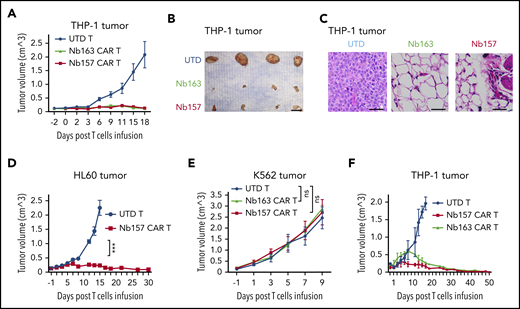 Nb-redirected CAR T cells potently eradicate AML tumor in vivo. (A-B) Ten million THP-1 cells were transplanted into NSG mice subcutaneously. The tumor reached 150 mm3 after ∼14 days. Three million Nb157 T cells, Nb163 CAR T cells, or UTD T cells were injected IV into the mice separately (n = 4). Tumor engraftment was monitored every other day. Scale bar, 10 mm. (C) Hematoxylin and eosin–stained THP-1 xenografts after treatment with UTD T cells, Nb163 CAR T cells, or Nb157 CAR T cells. Scale bars, 100 μm. (D) Three million Nb157 CAR T cells or UTD T cells were injected IV separately into NSG mice bearing HL60 tumors. Tumor engraftment was monitored every other day (n = 4). (E) Five million K562 cells were transplanted into NSG mice subcutaneously. The tumor reached 150 mm3 after ∼10 days. Three million Nb157 CAR T cells, Nb163 CAR T cells, or UTD T cells were injected into NSG mice separately. Tumor engraftment was monitored every other day (n = 4). (F) A total of 1.5 million Nb157 CAR T cells, Nb163 CAR T cells, or UTD T cells was injected IV separately into NSG mice bearing THP-1 tumor. Tumor engraftment was monitored every other day until the tumors were gone completely (n = 4). ***P < .001, 1-way analysis of variant. ns, not significant.