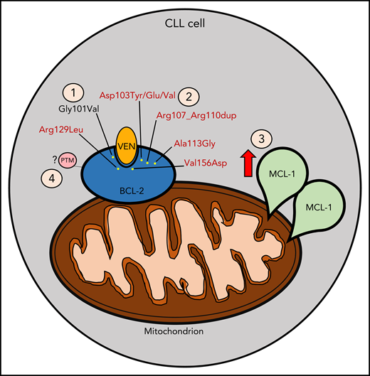 Mechanisms contributing to venetoclax (VEN) resistance. (1) Gly101Val mutation (in black) acquired following venetoclax treatment as previously described. (2) New mutations (in red) identified concomitantly with Gly101Val, as described by Blombery and colleagues. (3) MCL-1 overexpression following VEN treatment. (4) Potential posttranslational modification (PTM) that may contribute to VEN resistance (eg, phosphorylation events).