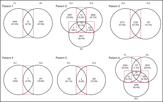Venn diagrams showing the number of shared and distinct subclones across disease events. Diagrams were generated by comparing the VDJ sequences of subclones in each disease event of a patient (Table 1) to identify the number of shared and unshared subclones. The numbers in the overlaps represent the number of shared subclones between disease events, whereas the numbers outside the overlap represent the number of unique subclones present for the particular disease event. Values in brackets represent the number of subclones as a percentage of the total number of subclones identified across all disease events. These values were rounded to 1 decimal point. For patient 3, the transformation sample was omitted from analysis because of the difference in CDR3 length in comparison with the first and second relapse. FL, FL diagnosis; FL1, first relapse; FL2, second relapse; FL3, third relapse; tFL1, relapsed tFL.