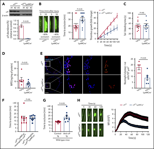 Myeloid specific α9−/− mice are less susceptible to experimental arterial thrombosis. (A) Western blot analysis of α9 integrin from bone marrow-derived neutrophils (top). Quantification (n = 3 mice/group) (bottom). (B) Representative microphotographs of carotid artery thrombus (7.5% FeCl3 injury) (left). Platelets were labeled ex vivo with calcein green. Time to occlusion (n = 11-12 mice/group) (middle). Rate of thrombus growth (n = 11-12 mice/group) (right). The rate of thrombus growth over a period of 2 minutes was calculated by dividing the area of the thrombus at time (n) by the area of the same thrombus at time (0) (defined as the time point at which the thrombus diameter first reached 30 μm). Slopes over time showed that the rate of thrombus growth in the α9fl/flLysMCre+ mice (slope, 0.1758) was decreased when compared with α9fl/fl mice (slope, 0.3575). *P < .05. (C) Tail bleeding assay (n = 8-10 mice/group). (D) MPO quantification by ELISA in carotid artery thrombus (n = 6-8 mice/group). (E) Representative immunofluorescence images of sections stained with anti-neutrophil elastase antibody. Scale bar, 100 μm. Boxed region is magnified to show colocalization of Hoechst/neutrophil elastase-positive cells (left). Quantification of neutrophil elastase-positive cells (n = 5-7 mice/group) (right). Value for each mouse represents a mean from 3 to 4 serial sections (each section separated by ∼70 μm). (F) Time to occlusion in α9fl/flLysMCre+ mice transfused with α9fl/fl mice neutrophils or α9fl/fl mice transfused with α9fl/fl LysMCre+ mice neutrophils (n = 10 vessels from 5 mice/group). (G) Time to occlusion in the wild-type mice (C57BL/6J) treated with anti-integrin α9 antibody or vehicle control (n = 10 vessels from 5 mice/group). (H) Representative microphotographs of mesenteric artery thrombus in the laser-injury model (left). Mean fluorescence intensity (MFI) over time (n = 19-22 vessels from 4 mice/genotype) (right).