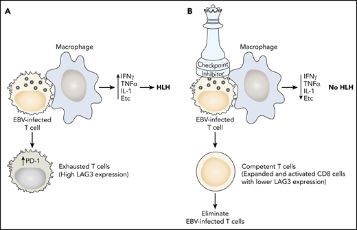 (A) In EBV-HLH, the viral infection causes a hyperinflammatory interaction with T cells and macrophages, resulting in excessive production of interferon-γ (IFNγ), tumor necrosis factor α (TNFα), interleukin-1 (IL-1), and other cytokines leading to HLH. Increased expression of PD-1 renders cytotoxic T cells incapable of controlling the infection (exhaustion). (B) Nivolumab binds to PD-1, rendering T cells competent to control the EBV infection and extinguish HLH.