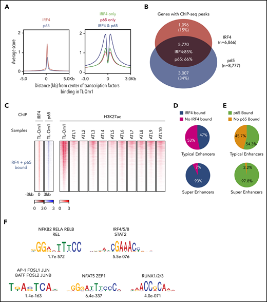 IRF4 and NF-κB co-occupy regulatory elements in ATL cells. (A) All regions bound by the IRF4 protein were first identified in TL-Om1 cells. The metagene plot on the left shows the distribution of IRF4 (red) and p65 (blue) ChIP-seq enrichment signals at the IRF4-bound regions (±5 kb from the binding sites) in TL-Om1 cells. The metagene plot on the right shows the levels of H3K27ac enrichment signals within ±3 kp from the center of the IRF4-p65 binding sites in TL-Om1 cells in the 3 groups: bound by IRF4 only (green), bound by p65 only (red), and bound by both IRF4 and p65 (blue). (B) Venn diagram depicting the distribution of the number of genes associated with IRF4 and p65 binding, as determined by ChIP-seq. (C) The density plots on the left show the distribution of the IRF4, p65, and H3K27ac signals for the genes bound by both IRF4 and p65 in TL-Om1 cells and of the H3K27ac signals in various primary ATL samples (ATL1-10). (D-E) Pie charts showing the percentage of IRF (D) and p65 (E) bound genes located in typical enhancers and super-enhancers. (F) The top 5 DNA binding motifs significantly enriched in transcription factor binding regions in each group are shown with P values.