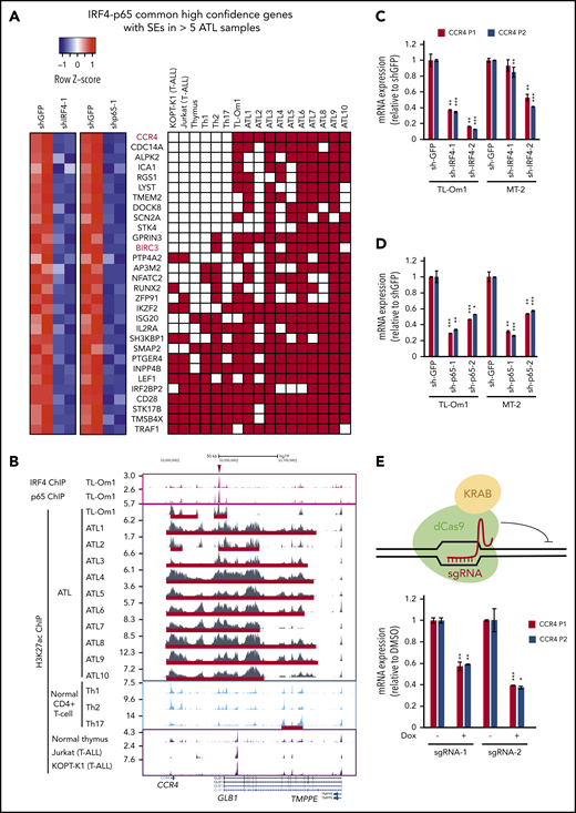 CCR4 is transcriptionally activated by IRF4 and NF-κB in ATL cells. (A) Among 399 genes selected in Figure 4A, 30 were found to be associated with super-enhancers in more than 5 of 11 ATL samples, including 10 primary ATL cases (ATL1-10) and TL-Om1. The heat map on the left shows the differential mRNA expression of these 30 genes upon knockdown of IRF4 and p65 in TL-Om1 cells. Super-enhancer status of these gene loci in T-ALL cells (KOPT-K1 and Jurkat cells), normal T-cells (thymus, Th1, Th2, and Th17) and ATL cells (TL-Om1 and 10 primary ATL samples) is shown on the right. Red, super-enhancer. (B) The ChIP-seq gene tracks represent the binding of IRF4 and p65, as well as the presence of H3K27ac marks near the CCR4 gene locus in various cell samples. See Figure 4D legend for details. The red lines indicate super-enhancer positions. (C-D) CCR4 mRNA expression in 2 ATL/HTLV-1-transformed T-cell lines (TL-Om1 and MT-2) was measured by qRT-PCR, using 2 different primer sets (P1 and P2) on day 3 after lentiviral transduction with various shRNAs. Expression was normalized to that of the internal control (GAPDH) and os presented as fold-changes compared with the sh-GFP control: as mean of SD of duplicates. *P < .05; **P < .01; ***P < .001 by a 2-sample, 2-tailed t-test compared with the sh-GFP control. (E) dCas9-KRAB-expressing TL-Om1 cells were transduced with 2 independent doxycycline (Dox)-inducible sgRNAs (sgRNA-1 and sgRNA-2) targeting the IRF4-NFκB/p65-bound region marked by the red arrowhead in Figure 5B. The expression levels of CCR4 were analyzed by qRT-PCR, using 2 different primer sets (P1 and P2), after 72 hours of Dox treatment. Expression was normalized to that of the internal control (GAPDH) and is presented as the fold-change relative to the dimethyl sulfoxide (DMSO)-treated control: as mean of SD of duplicates. *P < .05; **P < .01; ***P < .001 by a 2-sample, 2-tailed t-test compared with the DMSO-treated control.