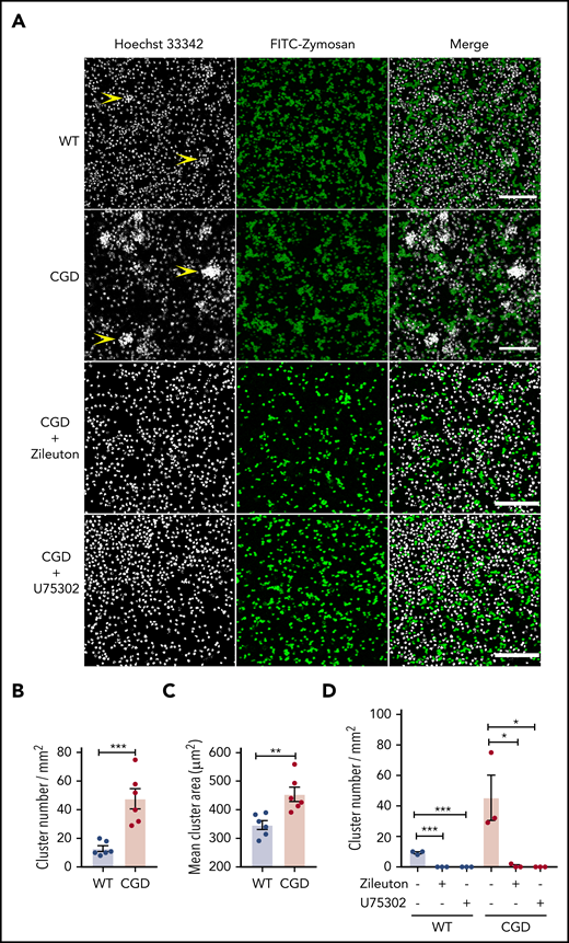 CGD neutrophils spontaneously formed larger and increased amounts of clusters in the presence of zymosan in vitro. Mouse BM neutrophils (4 × 106/mL) stained with 5 µg/mL Hoechst 33342 were stimulated for 1 hour with FITC-zymosan (MOI = 2). Images were acquired with LASX software (Leica Microsystems). (A) Representative images showing the neutrophil nuclei (white) and FITC-zymosan (green) and merged images of the 2 channels acquired by confocal microscopy. Examples of clusters are indicated by yellow arrowheads. Scale bars, 100 µm. (B) Quantification of the clusters and (C) cluster area. n = 6 in each group from 3 separate experiments. (D) CGD mouse BM neutrophils (4 × 106/mL) stained with 5 µg/mL Hoechst 33342 were preincubated with 30 µM zileuton or 10 µM U75302 for 10 minutes and then stimulated for 1 hour with FITC-zymosan (MOI = 2) in the presence of 30 µM zileuton or 10 µM U75302. Images were acquired by confocal microscope. (E) Quantification of the cluster number. n = 3 in each group from 2 separate experiments. Data are means ± standard error of the mean. *P < .05, **P < .01; ***P < .001, by Student t test. MOI, multiplicity of infection.