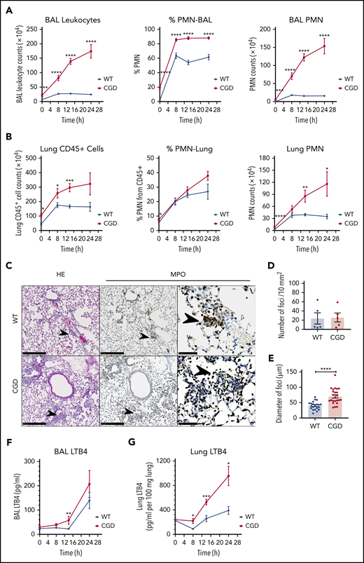Zymosan-induced lung inflammation was greater in CGD mice and was associated with increased LTB4. WT and CGD mice were challenged with 20 µg IN zymosan. BAL and lung tissues were collected at different time points. (A) Total leukocyte counts from 3 mL BAL fluid. The percentage of PMNs was determined by Cytospin with Wright-Giemsa stain. BAL PMN counts were calculated by Cytospin results. n ≥ 13 in each group from more than 3 independent experiments. (B) Lung cell counts from the right lung inferior lobe. The percentage of CD45+ cells and PMNs (CD45+Ly6G+CD11b+) was determined by flow cytometry. CD45+ cell and PMN counts were calculated by flow cytometry. n ≥ 3 in each group from more than 3 separate experiments. (C) Formalin-fixed, paraffin-embedded lung sections were stained with hematoxylin and eosin or processed for immunohistochemical study with MPO. Scale bars: 250 µm (left and middle panels); 50 µm (right panel). (D) Quantification of foci and (E) diameter of foci obtained with immunohistochemical staining with MPO of slides of cells from 5 different mice in each group. LTB4 levels in the first milliliter of BAL fluid supernatant (F) and whole-lung homogenate supernatant (G) were measured by ELISA. (F) n ≥ 7 in each group from more than 3 separate experiments; (G) n ≥ 3 in each group from more than 2 separate experiments. (A-B,E-G) Data are means ± standard error of the mean. *P < .05; **P < .01; ***P < .001; ****P < .0001, by Student t test.