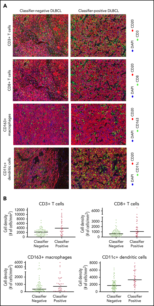 Immunofluorescence analysis of tissue specimens from DLBCL patients. (A) Representative fields (median) from images of classifier-negative and classifier-positive specimens stained for CD3+ and CD8+ T cells, CD20+ B cells, CD163+ macrophages, and CD11c+ dendritic cells (magnification, ×20). (B) Quantitative analysis of immune cell populations is shown as cell density (cells per mm2).