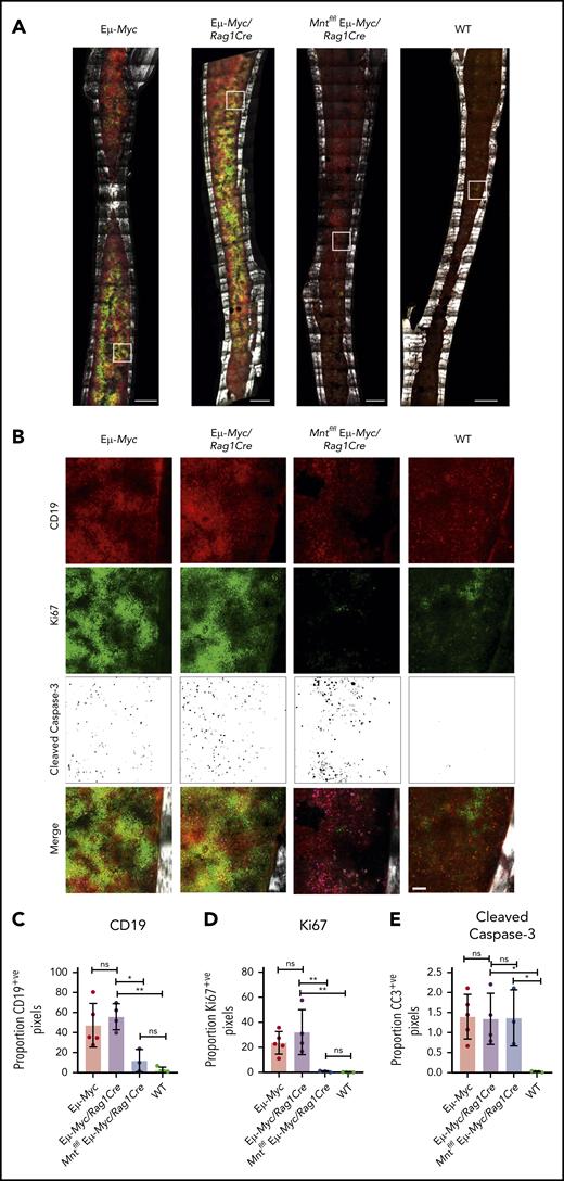 In situ analysis of cell proliferation and apoptosis. (A) Tilescan sections of whole tibia. Bones were harvested from 4-week old Eμ-Myc (n = 5), Eμ-Myc/Rag1Cre (n = 4), Mntfl/fl Eμ-Myc/Rag1Cre (n = 3), and WT (n = 4) mice, stained and imaged by combined 2-photon/confocal imaging of cell populations in situ. Red = CD19; green = Ki67; magenta = cleaved caspase-3; gray = second harmonic generation (bone). To better visualize CC3-positive cells in Figure 3B, the data are presented using an inverse black and white LUT (Lookup Table). Scale bar, 500 μm. (B) Zoomed areas from original tilescans in panel A (white boxes) with individual channels for CD19, Ki67, and cleaved caspase-3. A merged image (bottom panel) from each area is shown relative to bone signal (gray). Scale bar, 50 μm. (C-E) Quantification of cells in tibia positive for CD19, Ki67, and cleaved caspase-3. Color images were separated into single binary channels and then thresholded, and the number of positive pixels for each whole bone section quantified for CD19 (C), Ki67 (D) and cleaved caspase-3 (E). Each data point represents a whole quantified bone from an individual mouse in each genotype (n = 3-5). Bar graphs show mean ± SD; significance was determined by analysis of variance *P ≤ .05; **P ≤ .01).