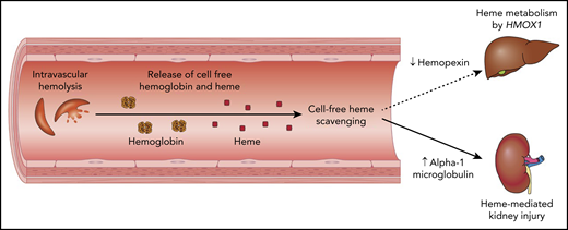 Acquired hemopexin deficiency, with a compensatory increase in A1M, leads to heme being transported to the kidney and causing tubular injury in SCD.