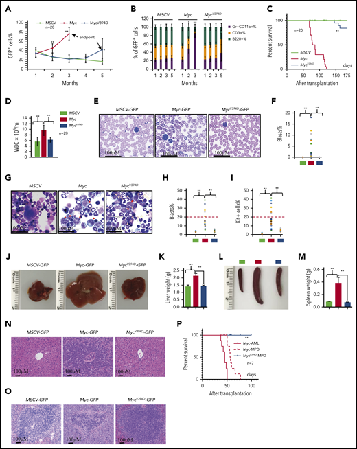 Reduced leukemogenic capacity of MycV394D-transduced HSPCs compared with Myc-transduced HSPCs. c-Kit+ HSPCs were transduced with MSCV-GFP, Myc-GFP, or MycV394D-GFP, respectively. The transduced HSPCs were purified by FACS 2 days posttransduction and transplanted into lethally-irradiated recipient mice, which were observed for leukemia development. Twenty mice were transplanted for each group. The blood cell engraftments of the transduced HSPCs were analyzed over time by examining the percentage of GFP+ cells in PB of the recipient mice (A). The data for the last time point in both Myc and Mycv394d groups were collected when the mice were euthanized (end point). The lineage commitments of the transduced HSPCs were evaluated by examining the percentages of Gr1+CD11b+ myeloid cells, B220+ B lymphocytes, and CD3+ T lymphocytes within the GFP+ cells (B). Survival of the recipient mice is demonstrated by Kaplan-Meier analysis (C). Leukemia/MPD was verified immediately after the death of the mice by examining the WBCs in PB (D), leukemic blasts in PB (E-F), leukemic blasts in BM (G-I), liver size (J-K), spleen size (L-M), as well as leukemic cell infiltration in livers (N) and spleens (O). *P < .05; **P < .01. (P) BM cells were collected from Myc-AML, Myc-MPD, and MycV394D-MPD mice and transplanted into second-round recipient mice, respectively. Mice were observed for AML or MPD-related death. The survival of the recipient mice is demonstrated by Kaplan-Meier analysis.