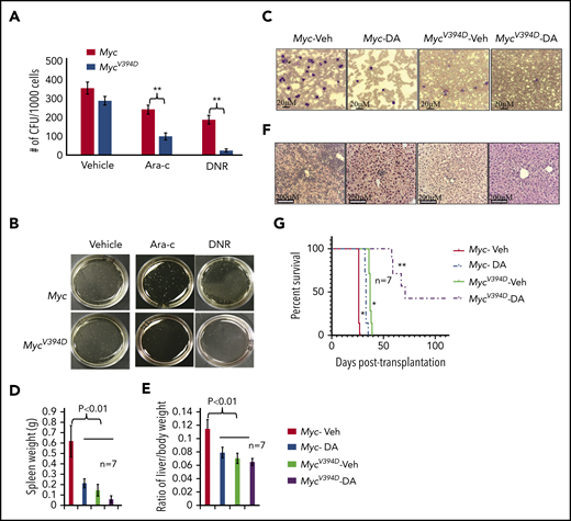 Increased sensitivity of MycV394DAML cells to chemotherapy compared with Myc AML cells. (A-B) Myc- and MycV394D-AML cells were seeded into methylcellulose medium for CFU assay with or without Ara-C and DNR treatment. CFUs were counted (A) and imaged (B) on day 7 of culturing. (C-G) Myc/CreERTMycfx/fx and MycV394D/CreERTMycfx/fx AML cells were transplanted into recipient mice. Beginning on day 3 after transplantation, mice were treated with TAM every day for 5 consecutive days to induce the deletion of endogenous Myc. Beginning on day 8 after transplantation, mice were treated with D3+A5 regimen of chemotherapy. A panel of mice was euthanized on day 24 posttransplantation to assess the development of leukemia by examining leukemic blasts in PB smears (C), spleen size (D), liver size (E), and leukemic cell infiltration into livers (F). The other panel of mice was monitored for leukemia-related death (G). *P < .05 compared to Myc-Veh group; **P < .01 compared to Myc-DA group. DA, daunorubicin and cytarabine.