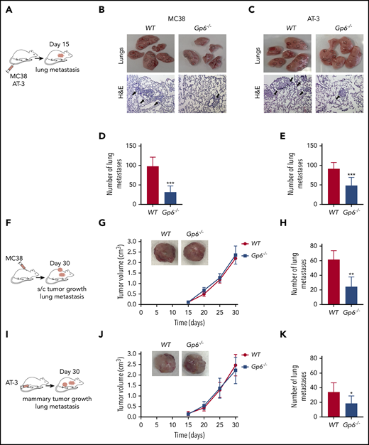 Lack of platelet GPVI inhibits tumor metastasis. (A) Schematic of a lung colonization assay after IV injection of MC38 colon (B,D) or AT-3 breast (C,E) cancer cells in WT and Gp6−/− mice. (B,C) Representative photographs (top) and hematoxylin-eosin–stained sections (bottom) obtained from the lungs of MC38 and AT-3–injected WT and Gp6−/− mice. (B,C) Dashed black circles and arrows indicate metastatic nodules. The bar represents 200 µm. (D,E) Bar graphs representing the number of lung metastases in MC38 (D)- and AT-3 (E)–injected WT and Gp6−/− mice. Mean ± standard deviation (SD); n = 5 (D) and n = 7 (E) mice per group. ***P < .001, by unpaired Student t test. (F,I) Schematic of mouse heterotopic and orthotopic metastasis assays. MC38 (F-H) and AT-3 (I-K) tumor cells were injected subcutaneously or into the fourth mammary fat pad of WT and Gp6−/− mice, and the volume of subcutaneous (G) or mammary (J) tumors and the number of lung metastases was determined. (G,J) Kinetic of primary tumor growth in WT and Gp6−/− mice. Mean ± SD; n = 5 (G) and n = 8 (J) per group. (H,K) The number of spontaneous lung metastases in MC38 (H)- and AT-3 (K)–injected WT and Gp6−/− mice. Mean ± SD; n = 6 (H) and n = 8 (K) mice per group. *P < .05; **P < .01, by Mann-Whitney test.