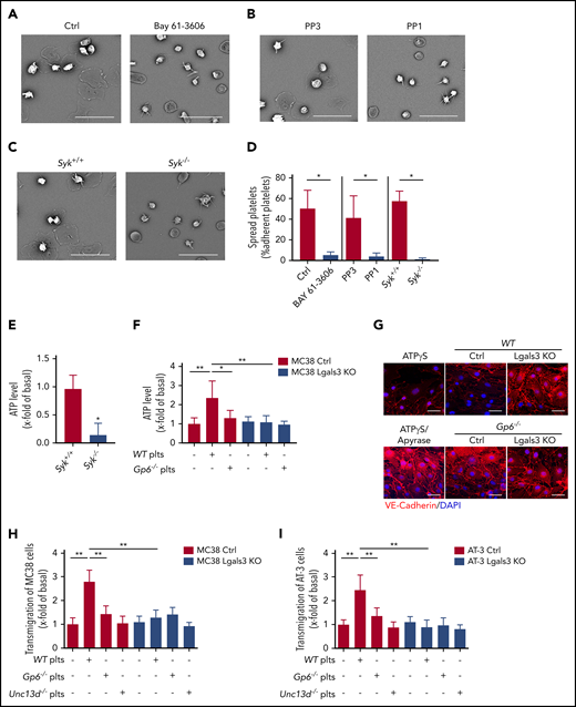 Interaction between GPVI and galectin-3 promotes tumor cell–induced platelet activation, degranulation, and transendothelial migration. (A-C) Representative SEM images of mouse platelets adhering to recombinant galectin-3. Washed WT mouse platelets were incubated for 10 minutes with 10 µmol/L of the Syk inhibitor Bay 61-3606 (A) and Src-kinase inhibitor PP1 and its nonfunctional analog PP3 (B) and was allowed to adhere to galectin-3–coated surfaces. (C) Similar experiments were performed with Syk+/+ and Syk−/− mouse platelets. The morphology of the adhering platelets was examined after 1 hour, and (D) the percentage of spread platelets was quantified for each condition. The bar represents 20 µm. Mean ± standard deviation (SD) of n = 4 mice per group; *P < .05, by Mann-Whitney test. (E) Relative levels of ATP released from platelets (Syk+/+ and Syk−/−) adhering to dalectin-3. Mean ± SD; n = 4 mice per group; *P < .05, by Mann-Whitney test. (F) Relative levels of ATP released from WT and Gp6−/− platelets incubated with control MC38 (Ctrl) or Lgals3 KO tumor cells. Data are presented as the mean ± SD of 4 separate experiments. *P < .05, **P < .01, by 1-way analysis of variance followed by Tukey’s post hoc test. (G) bEnd.3 mouse endothelial cells (ECs) incubated with supernatants derived from platelets (Plts) tumor cell (TC) cocultures (WT Plts+MC38 ctrl or Lgals3 KO TC) and (Gp6−/− Plts+MC38 Ctrl or Lgals3 KO TC), or with 10 µM ATPγS, alone or in combination with 20 U/mL apyrase, for 8 hours. Representative immunofluorescence images of ECs with an anti-VE-cadherin antibody (red). Nuclei were stained with 4′,6-diamidino-2-phenylindole (DAPI; blue). The bar represents 10 µm. (H-I) MC38 and AT-3 ctrl or Lgals3 KO tumor cells were seeded on endothelial cells (ECs), and tumor cell transmigration was determined in the absence or presence of WT, Gp6−/−, and Unc13d−/− plts. Data are presented as the mean ± SD of 6 separate experiments. **P < .01, by Mann-Whitney test.