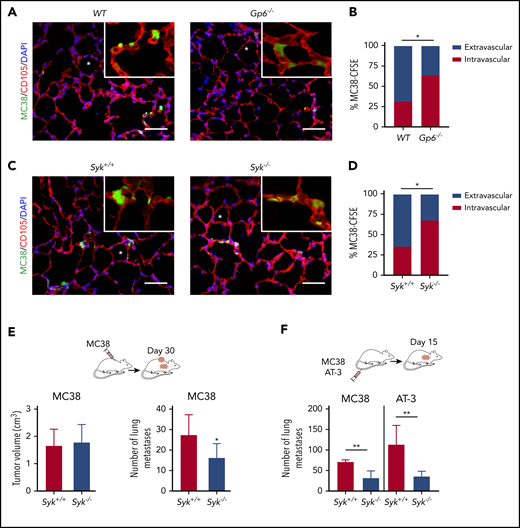 GPVI–galectin-3 interaction promotes tumor cell extravasation and subsequent metastasis. (A,C) Representative fluorescence microscopy images of lung sections of WT, Gp6−/− (A) and Syk+/+ and Syk−/− (C) mice 6 hours after IV injection of MC38-CFSE cells (green). Lung vessels were stained for endoglin (CD105, red). Asterisks indicate lung alveoli. The bar represents 10 µm. (B-D) The bar graphs show the percentage of intravascular and extravascular MC38-CFSE cells in lungs of WT, Gp6−/−, Syk+/+ and Syk−/− mice; n = 4 mice per group; *P < .05, by Fisher’s exact test. (E-F) MC38 and AT-3 tumor cells were injected subcutaneously (E) or directly into the tail vein (F) of Syk+/+ and Syk−/− mice. Spontaneous and experimental lung metastasis were determined at 30 and 15 days after injection, respectively. (E) Quantification showing primary tumor volume (left) and number of metastases (right). (F) Metastases in lungs of Syk+/+ and Syk−/− mice. Data are presented as the mean ± standard deviation (SD); n = 5 mice per group; *P < .05; **P < .01, by Mann-Whitney test.